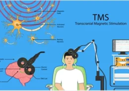 What is TMS?